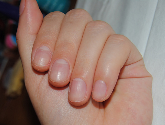 Kısa Tırnak Nasıl Uzatılır?